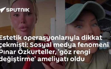 göz rengi değiştirme
