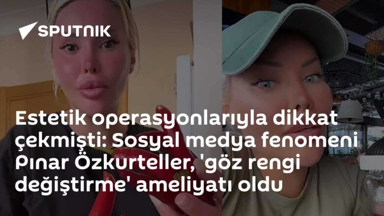 göz rengi değiştirme