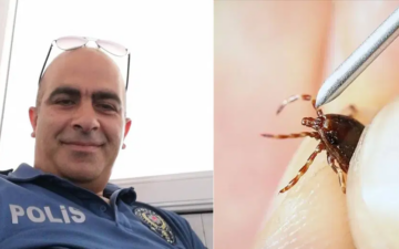 Kırım Kongo Ateşi