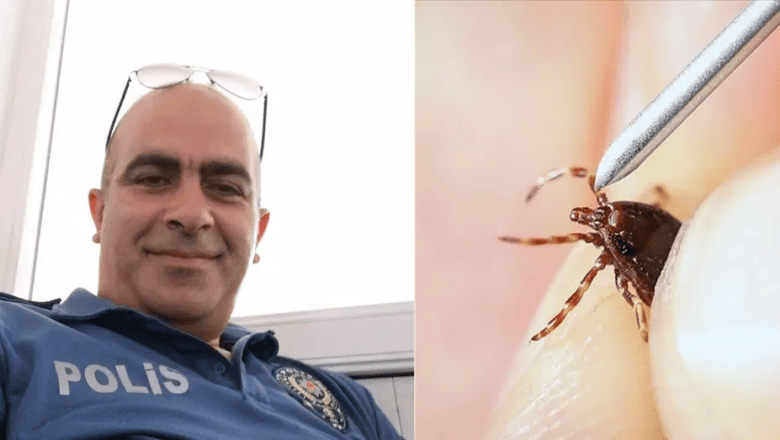 Kırım Kongo Ateşi